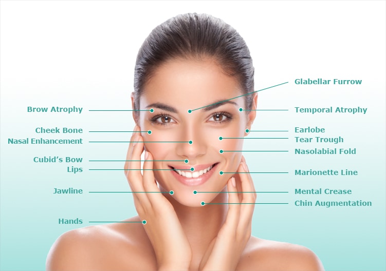 Image showing face of a female, listing the anatomy of the face useful when using dermal fillers for wrinkles treatment.