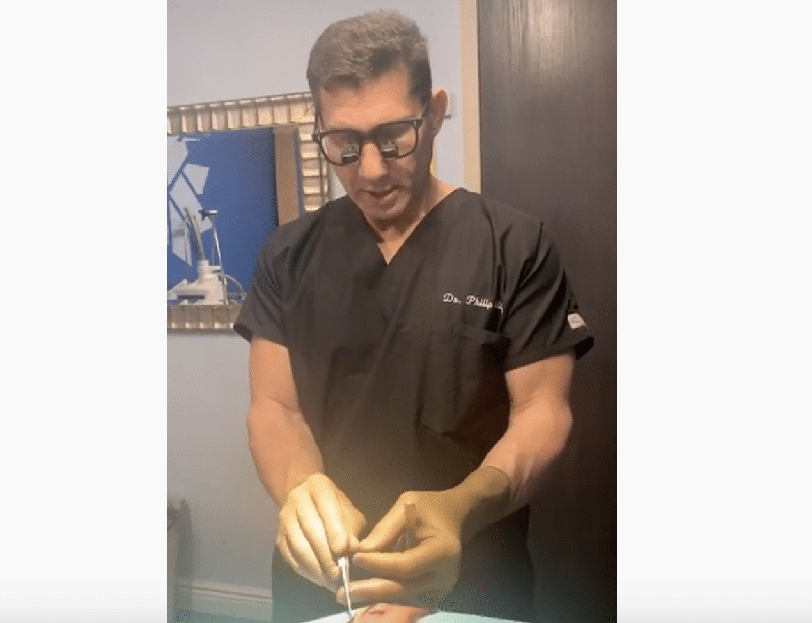 Scar Removal Surgery Demonstration by Dr. Philip Miller