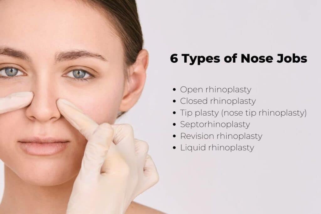 six types of nose jobs