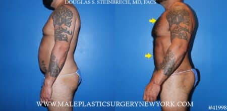 270° Torso Tuck with body banking to the pecs and glutes by Dr. Steinbrech