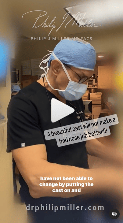 dr miller explaining casts after rhinoplasty