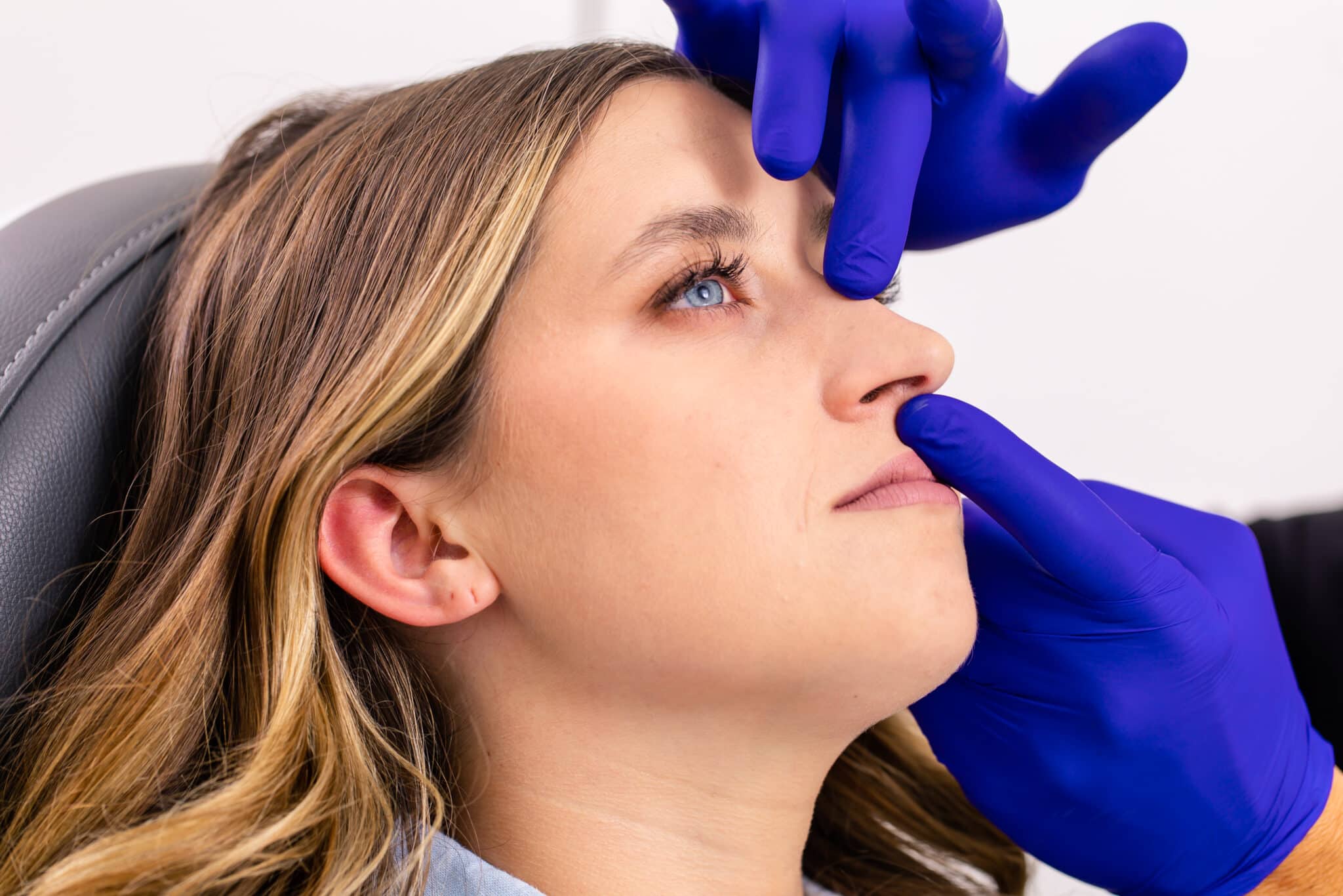 ski slope nose rhinoplasty patient in new york