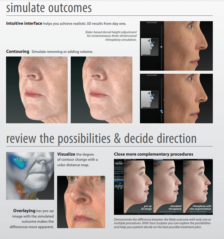 saddle nose rhinoplasty 3d imaging before the procedure