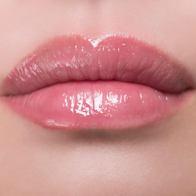 lips after lip lift